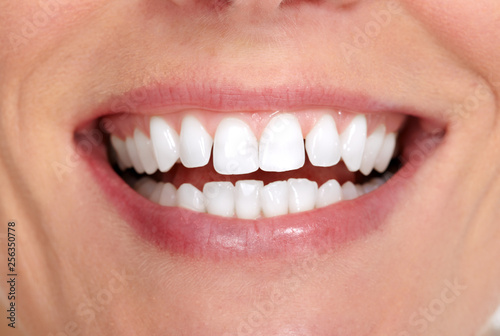 woman smile and teeth © Kurhan